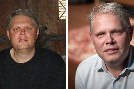 pinched fingers illustration